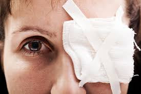 First Aid for Eye Injuries