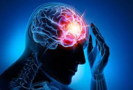 Symptoms of a Concussion